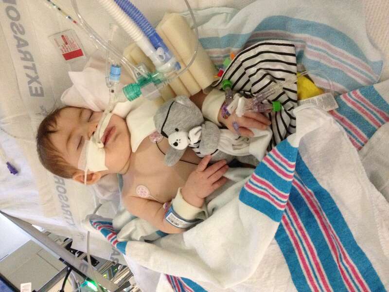 This is a child with diagnosed infant botulism. He is unable to move or open his eyes. His cry is barely audible. He is awake and not sedated.