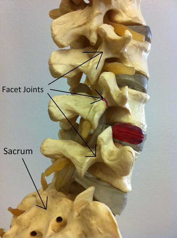 Wrong descriptions: the upper 3 arrows should be partes interarticulares 